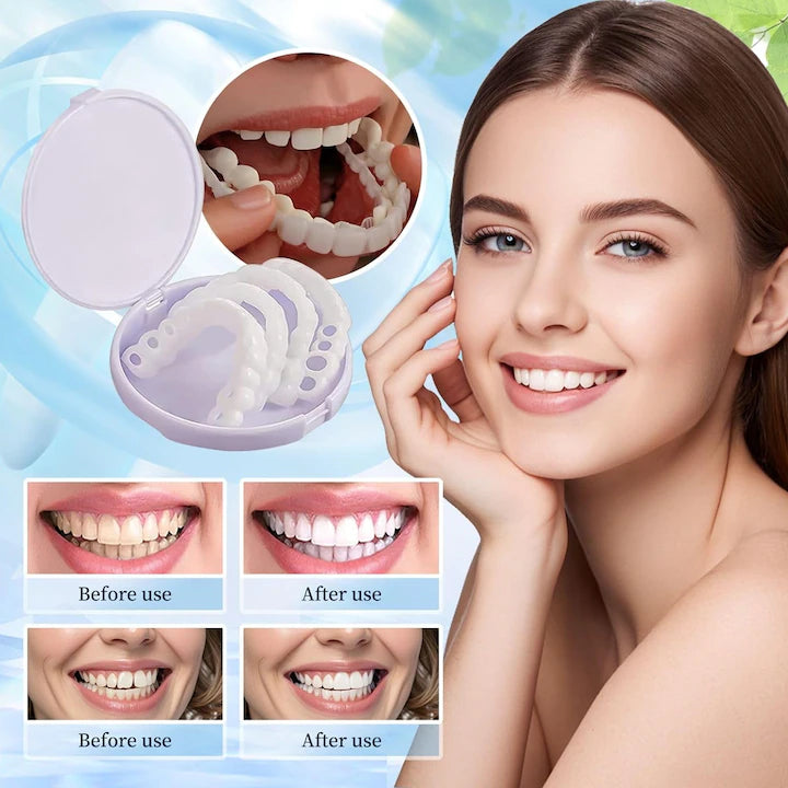 Snap On Smile - Snap On Smile