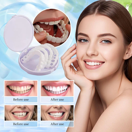 Snap On Smile - Snap On Smile